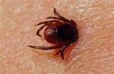 新型布尼亚病毒,今天你了解了吗?